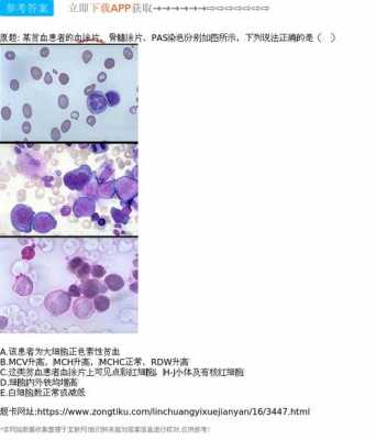 贫血骨髓染色用哪一种染料好-贫血骨髓染色用哪一种染料-图2