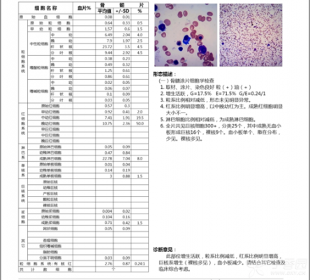 贫血骨髓染色用哪一种染料好-贫血骨髓染色用哪一种染料-图1