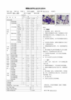 贫血骨髓染色用哪一种染料好-贫血骨髓染色用哪一种染料-图3