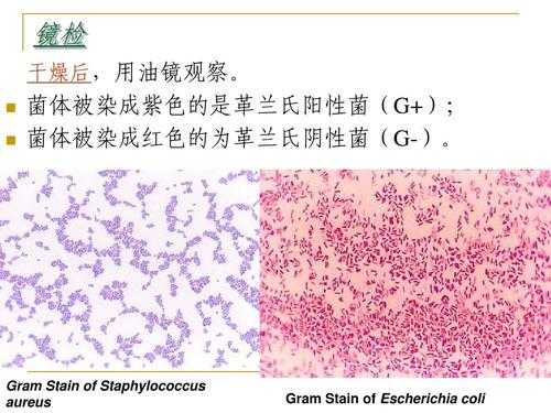 芽孢染色法的应用 常用于芽孢染色的染料-图2