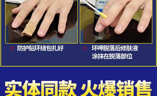  指甲磨痕修复膏有用吗「指甲磨了怎么修复」-图1