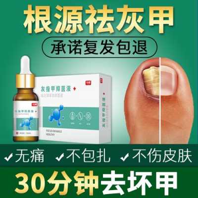 灰指甲修复液中药制剂（灰指甲修复膏的功效和作用）-图3