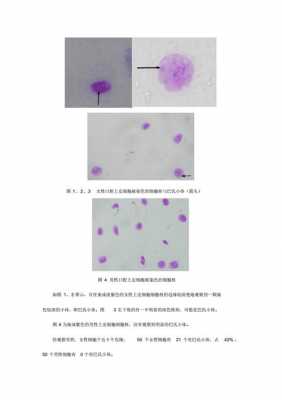 x染色质的制备与观察实验报告 x型染料染色实验目的-图1