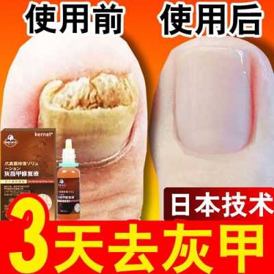 日本修复脚指甲神器,趾甲修复液 -图3