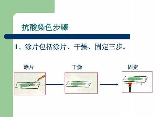 抗酸染色的基本原理-图2