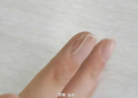 指甲劈了如何修复好 指甲劈了如何修复-图1