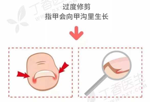  受损指甲修复多久好啊「受损的指甲多久能好」-图3