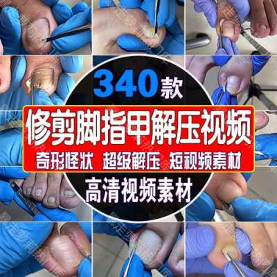 修复脚指甲解压视频大全-修复脚指甲解压视频-图3