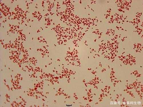 大肠杆菌染色后的形状及颜色 大肠杆菌染料染色-图1