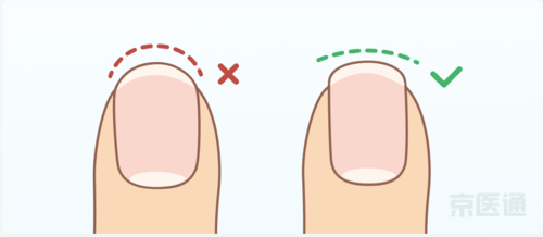  指甲强韧修复手法图谱图片「指甲强韧修复手法图谱图片高清」-图3