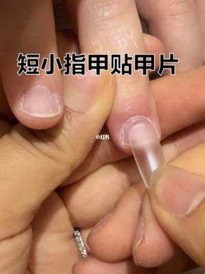 甲片和指甲分离修复多少钱,甲片和指甲一起断了 -图3