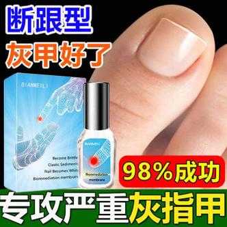  指甲增厚修复液有用吗「指甲增厚修复液有用吗图片」-图1