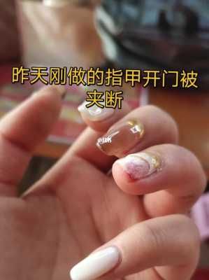 刚做的指甲花了怎么修复_刚做的指甲怎么弄掉-图2