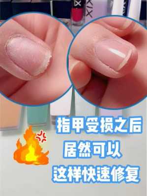 指甲修复妙用视频大全-指甲修复妙用视频-图2