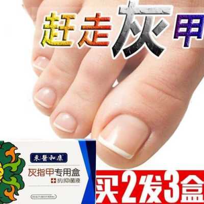 灰指甲脚趾美甲修复多少钱啊-灰指甲脚趾美甲修复多少钱-图2