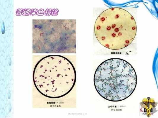 细菌染色为什么碱性染料不一样 细菌染色为什么碱性染料-图2