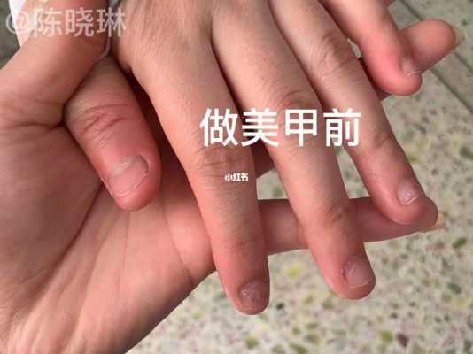 咬过的指甲美甲修复要多久（咬过的指甲怎么变回去）-图2