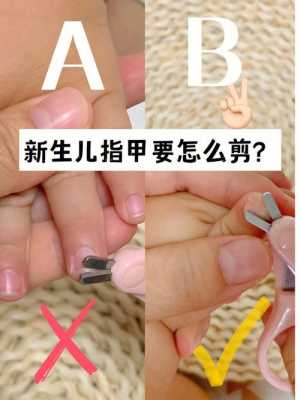  孩子的指甲盖怎么修复好「小孩指甲应该怎样修剪?」-图1