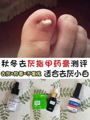 指甲印用什么药治疗呢 去指甲印疤痕修复药膏有哪些-图3