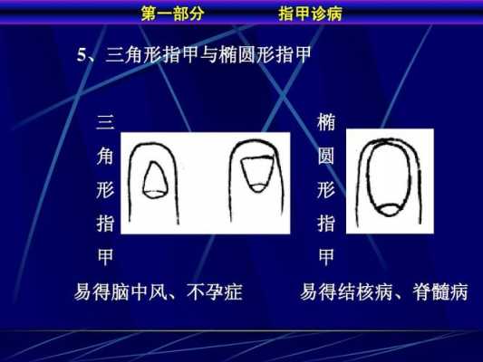 指甲椭圆和圆形什么区别-图3