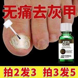  斯达非灰指甲修复液「斯达非灰指甲修复液有用吗」-图2