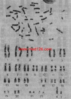 染色体被吉姆染料染色后显示的G带_吉姆萨染色显示的g带-图1