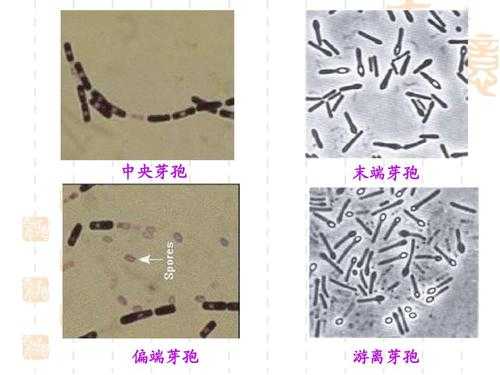 芽孢染色时的染料_芽孢染色的成败关键-图2