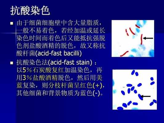 抗酸染色所用染料的顺序是怎样的（抗酸染色的染色程序）-图2