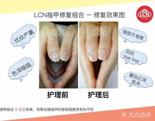 lcn指甲修复是什么意思-lcn指甲修复-图2