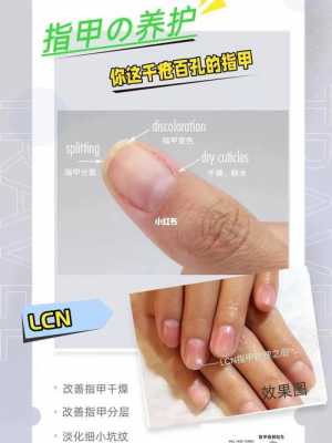 lcn指甲修复是什么意思-lcn指甲修复-图1