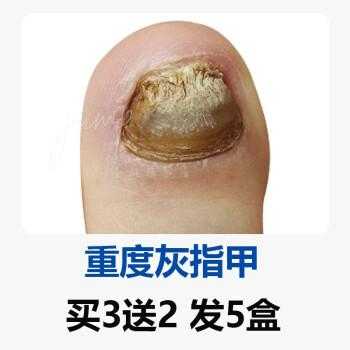 迈瑞普指甲修复液好用吗,迈瑞普指甲修复液好用吗多少钱 -图2