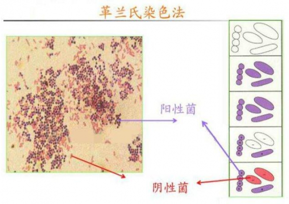 革兰染色染料毒性（革兰染色的成分）-图2