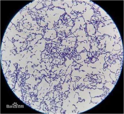 细菌活死染色染料是什么（细菌活菌染色）-图2