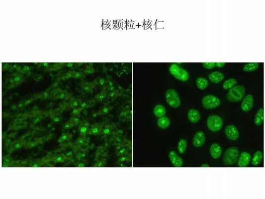 核仁可被碱性染料染色吗（核仁染色淡的原因）-图3