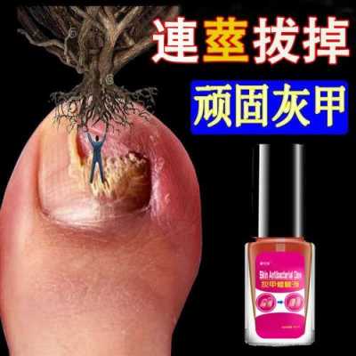 指甲修薄了还会厚起来吗-指甲薄变厚修复液有用吗-图3