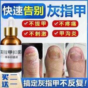 指甲受损后如何恢复用什么药物-图1