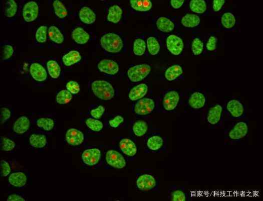  细胞核碱性染料染色「核仁被碱性染料染色」-图2