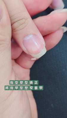 怎么让指甲变窄修复好呢（如何让指甲变窄）-图1