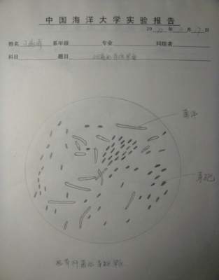 芽孢染色加热的目的是什么?不加热行不行?-芽孢染色为什么染料不能干-图1