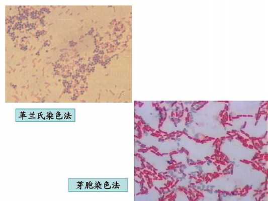 革兰染色的染料第四液为-革兰染色的染料第三液为-图3