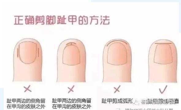 剪指甲残甲修复要多久做完-图3