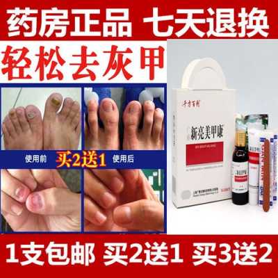  甲姿迪灰指甲修复液有用吗「甲可迪能治疗灰指甲吗」-图3