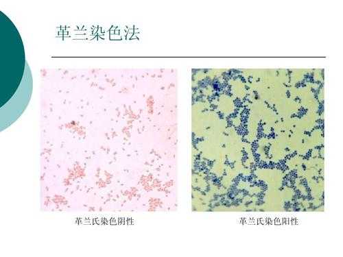  革兰染色为何常用碱性染料「革兰染色结果为什么是两种颜色」-图2