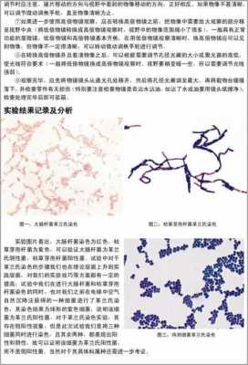  革兰染色为何常用碱性染料「革兰染色结果为什么是两种颜色」-图1