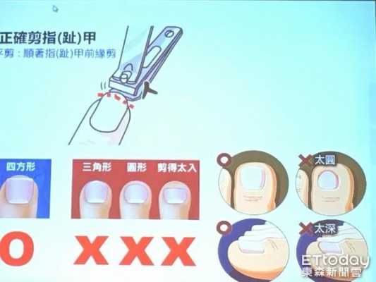 剪指甲剪断了怎么修复图片大全-剪指甲剪断了怎么修复图片-图2