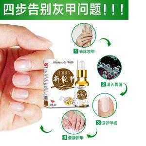  修复指甲的物质有毒吗「修复指甲的药膏」-图3