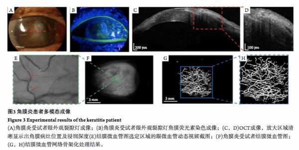 角膜荧光染色使用什么染料_角膜荧光色染色检查是什么-图3