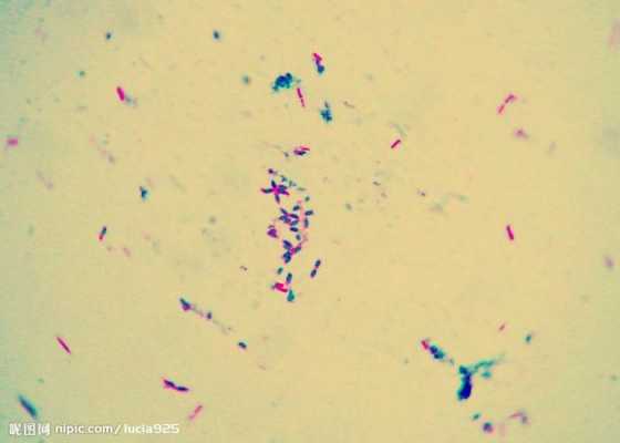 细菌一般用什么染料染色的-细菌一般用什么染料染色-图2