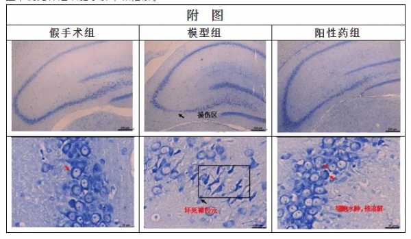 尼氏体染色实验原理-图2