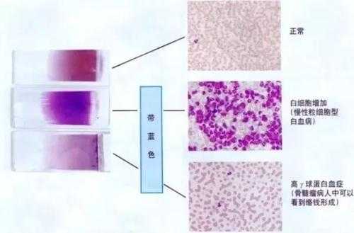 用碱性染料染色时染色质中着色浅的部位揭示的是-图3